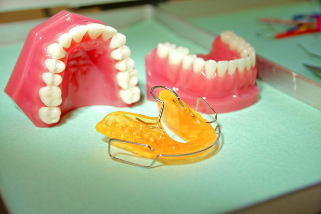 Bionator im Haus der Zahngesundheit Köln – sanfte, ganzheitliche Kieferorthopädie für Kinder und Erwachsene zur Förderung von Kieferbalance und Atmung.