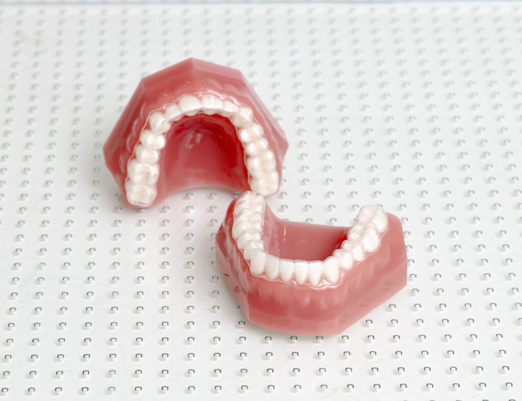 Transparenter Aligner auf Zahnmodell – ganzheitliche Kieferorthopädie bei Dr. Paula Göser im Haus der Zahngesundheit Köln