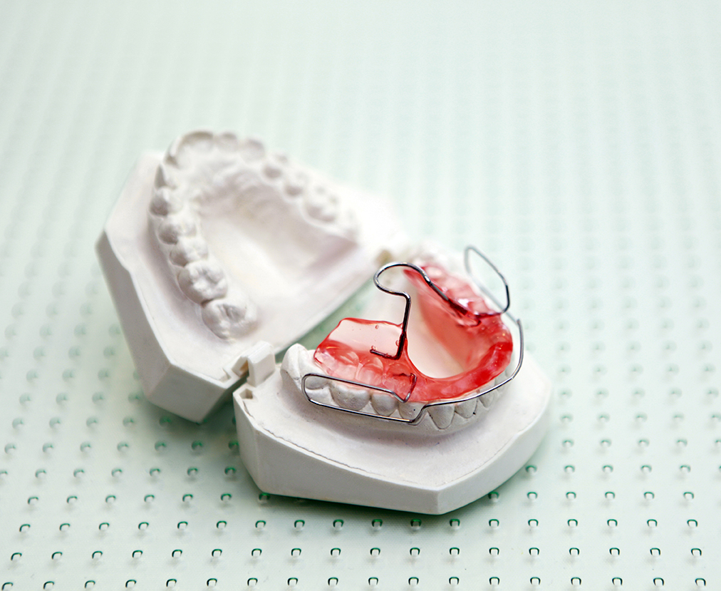 Bionator auf Zahnmodell – ganzheitliche Kieferorthopädie bei Dr. Paula Göser im Haus der Zahngesundheit Köln