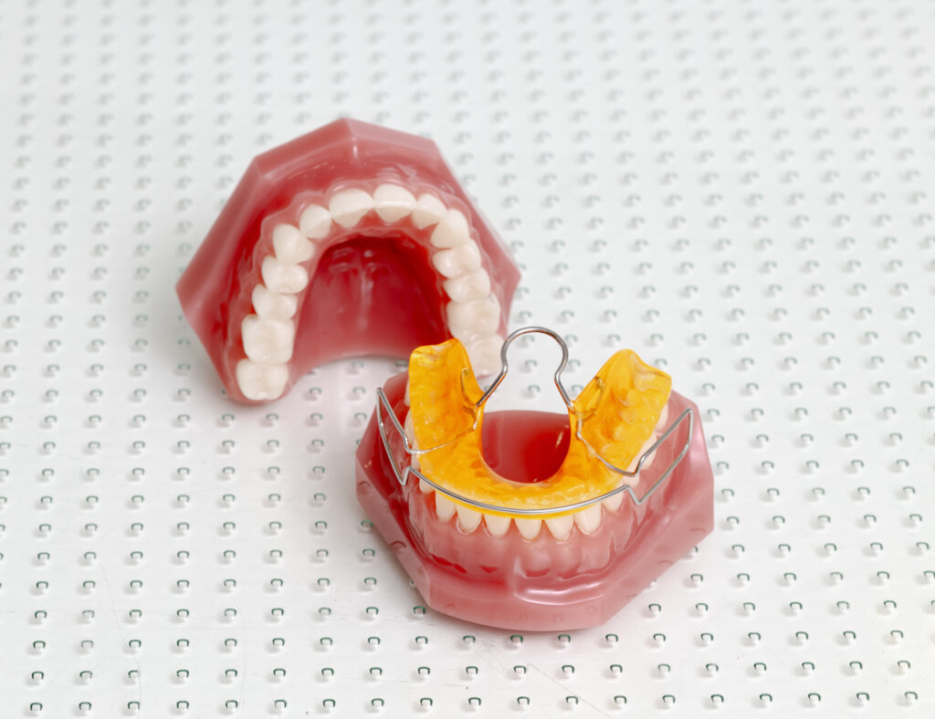 Bionator auf Zahnmodell – ganzheitliche Kieferorthopädie bei Dr. Paula Göser im Haus der Zahngesundheit Köln