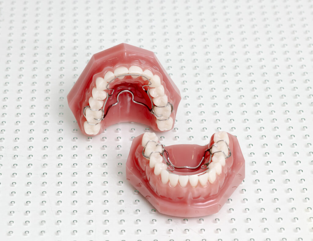 Crozat-Gerät auf Zahnmodell – ganzheitliche Kieferorthopädie bei Dr. Paula Göser im Haus der Zahngesundheit Köln