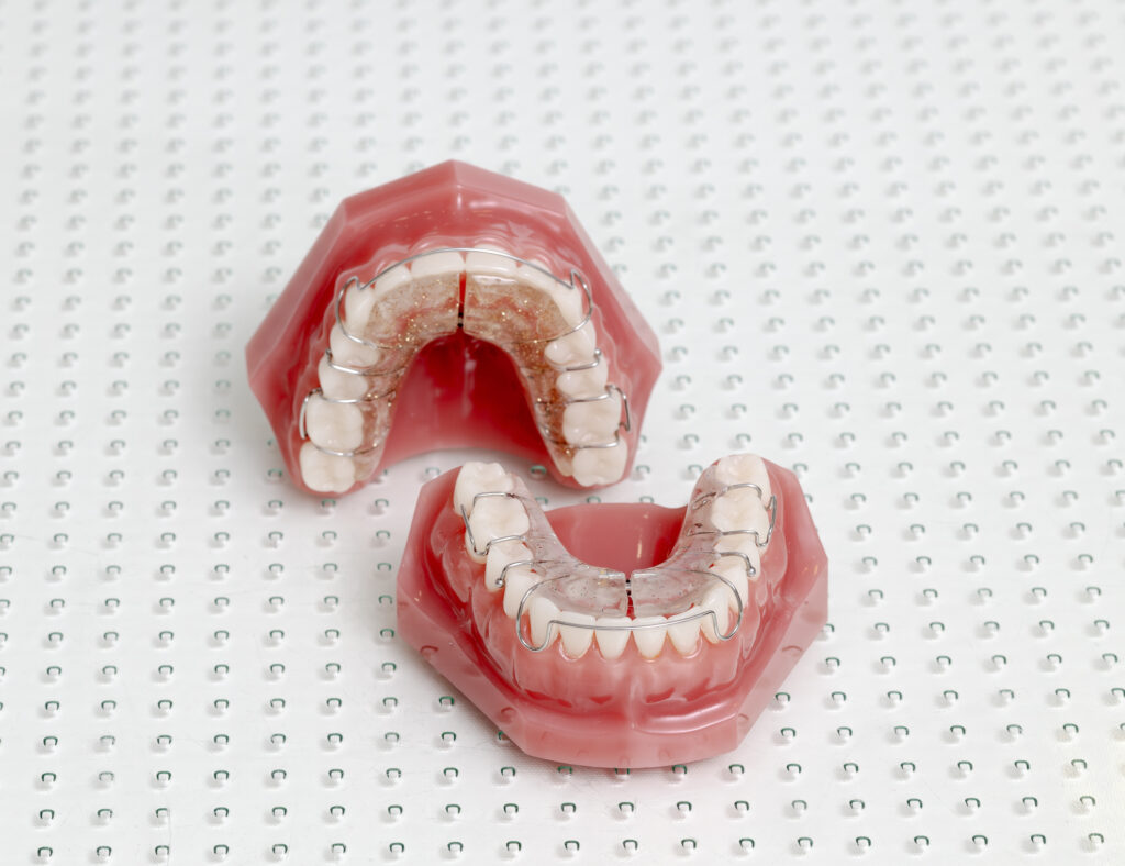 Dehnplatte zur sanften Erweiterung des Kiefers im Haus der Zahngesundheit Köln bei Dr. Paula Göser