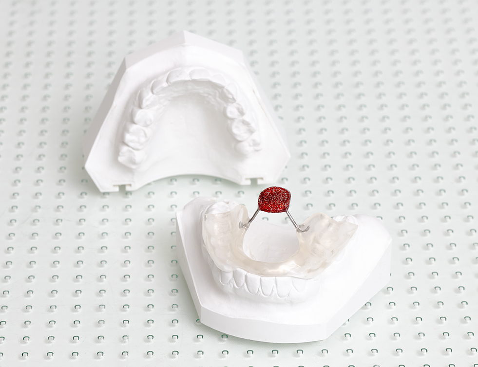 Linguator-Schiene zur sanften Entlastung der Kiefergelenke und Muskulatur im Haus der Zahngesundheit Köln